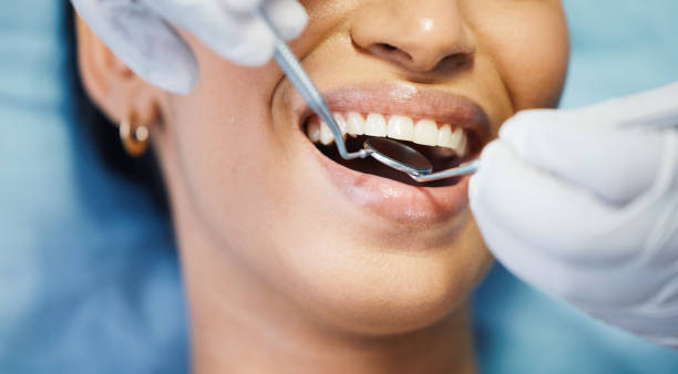 Best Emergency Tooth Extraction in Stanfield, NC