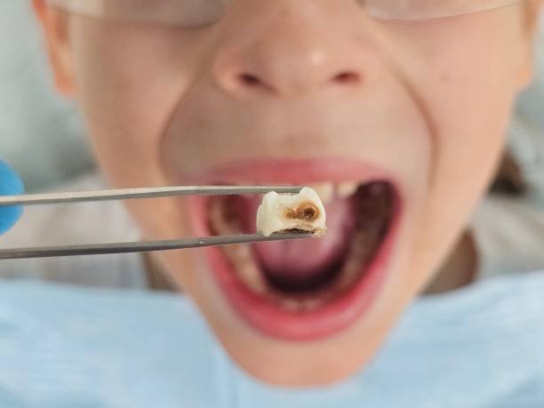 Best Emergency Gum Treatment in Stanfield, NC